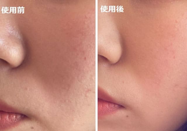 ダイソーのコレ正直なめてました…!他で買ったら千円してもおかしくない!300円美容グッズ♡