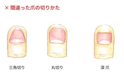 爪切りや靴下で簡単にできる「足のトラブル予防ケア」を実践しよう!